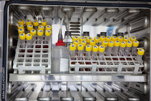 Test tubes with blood samples in the incubator during the process of preparation for karyotype and fluorescence in situ hybridization - FISH in the laboratory photo