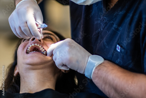 applying dental braces