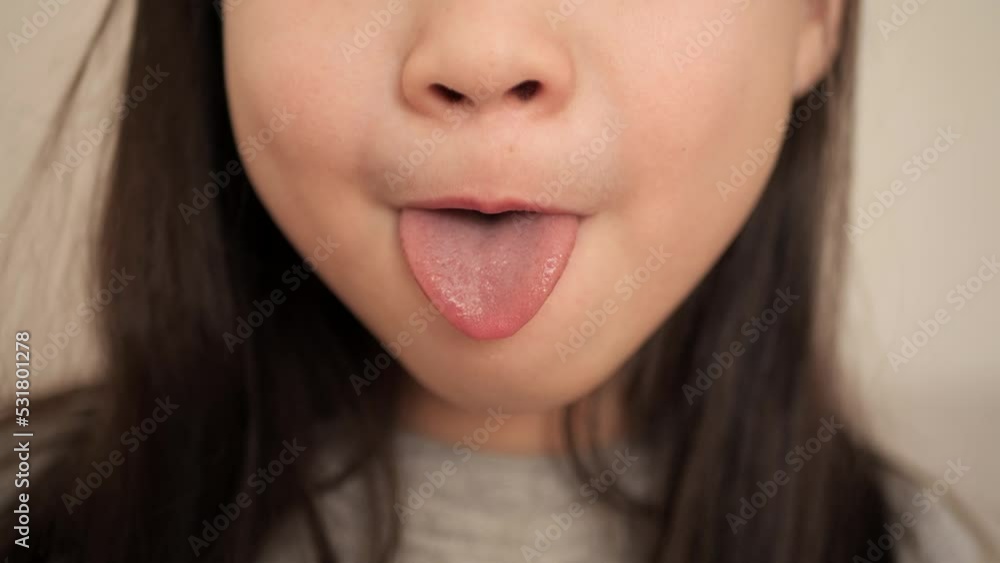 Little girl sticking out her tongue and teeth. Close-up of a girl face smile. Child shows mouth to the doctor. Health concept. Little girl sticking out her tongue and teeth. Close-up of a girl face smile. Child shows mouth to the doctor. Health concept.