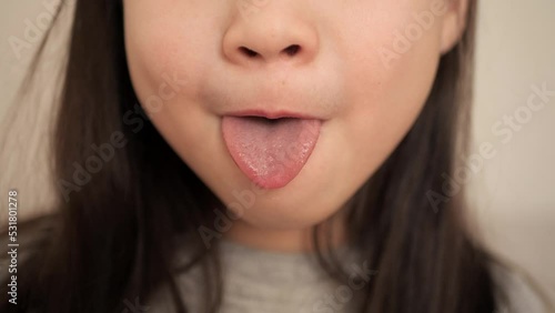 Little girl sticking out her tongue and teeth. Close-up of a girl face smile. Child shows mouth to the doctor. Health concept.
