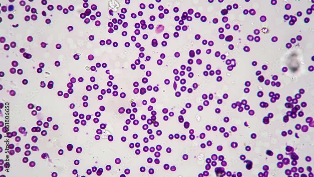 Smear of human blood under microscope with 400 times magnification on ...