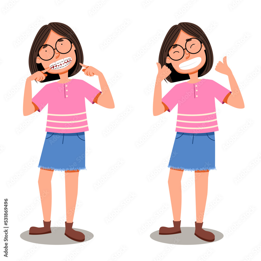Cute Asian girl shows a smile with braces and without braces. Vector illustration in a flat style on the topic of dentistry. Cute Asian girl shows a smile with braces and without braces. Vector illustration in a flat style on the topic of dentistry.