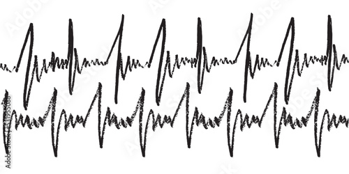 Medical texture design with ekg diagram and heart shape