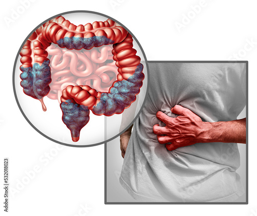 Constipation anatomy and constipated symptoms as stool bowel movement problem as an Intestine and rectum of a digestive system on white with 3D illustration elements photo