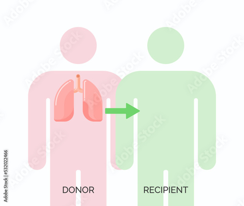 Human organ transplantation concept. Vector illustration of donor and recipient of lungs organ