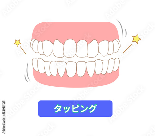 歯ぎしりの種類   タッピング