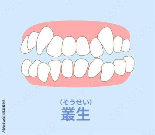 歯科矯正　歯並び　叢生、反対咬合、開咬、上顎前突、空隙歯列、すきっ歯.