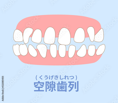 歯科矯正　歯並び　叢生、反対咬合、開咬、上顎前突、空隙歯列、すきっ歯.