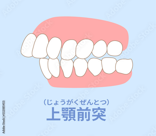 歯科矯正　歯並び　叢生、反対咬合、開咬、上顎前突、空隙歯列、すきっ歯.