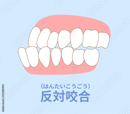 歯科矯正　歯並び　叢生、反対咬合、開咬、上顎前突、空隙歯列、すきっ歯.