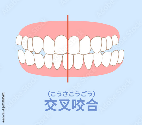 歯科矯正　歯並び　叢生、反対咬合、開咬、上顎前突、空隙歯列、すきっ歯.