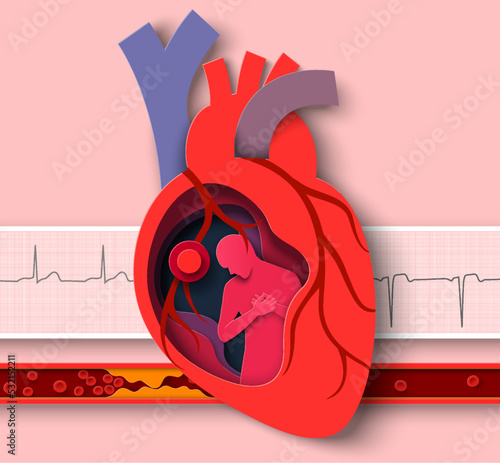 Heart attack paper cut vector cardiology disease