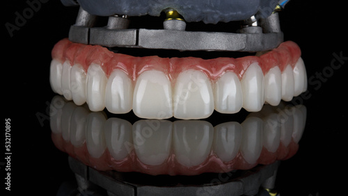 excellent temporary dental prosthesis of the upper jaw and models with a bar on black glass with reflection