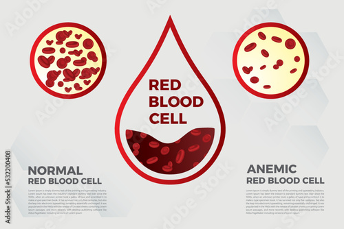 Anemia Iron red blood cell medical vector illustration medical.
