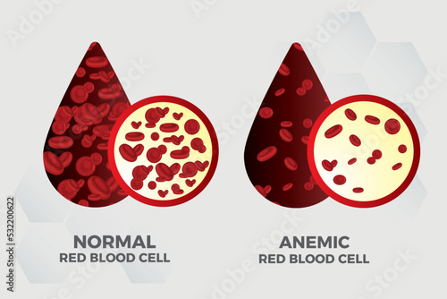 Anemia Iron red blood cell medical vector illustration medical.
