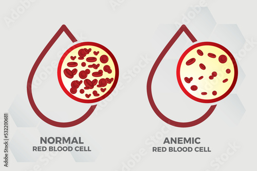 Anemia Iron red blood cell medical vector illustration medical.

