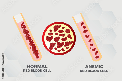 Anemia Iron red blood cell medical vector illustration medical.
