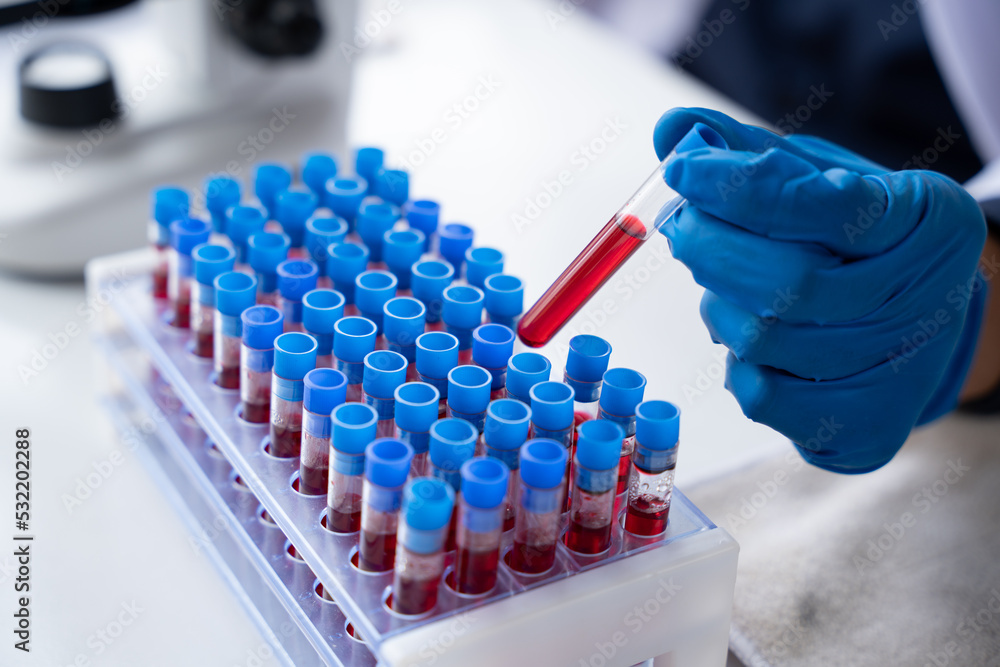 Doctor hand taking a blood sample tube from a rack with machines of analysis in the lab background, Technician holding blood tube test in the research laboratory. Doctor hand taking a blood sample tube from a rack with machines of analysis in the lab background, Technician holding blood tube test in the research laboratory.