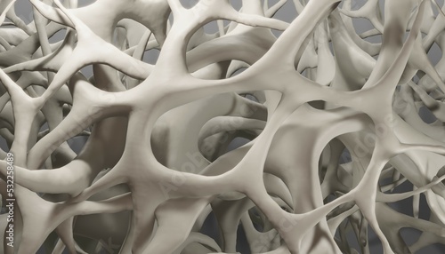 Photos Osteoporosis, bone loss 3d illustration