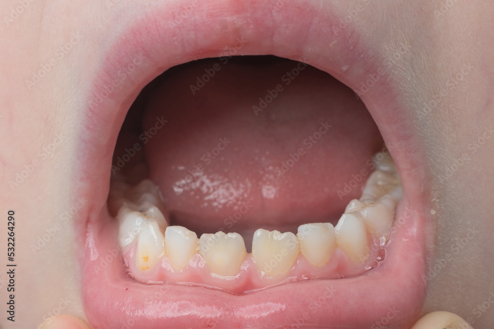 Obraz premium Jaw with children's straight teeth close-up.
