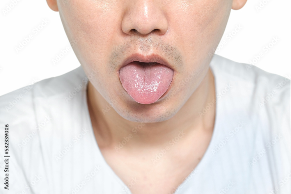 Close-up of a young man. He sticks his tongue out of his mouth to show his tongue. health and medical concepts Close-up of a young man. He sticks his tongue out of his mouth to show his tongue. health and medical concepts