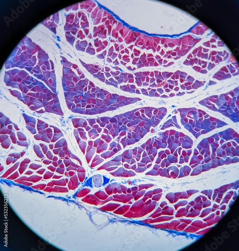 photo of striated muscle tissue under the microscope photo