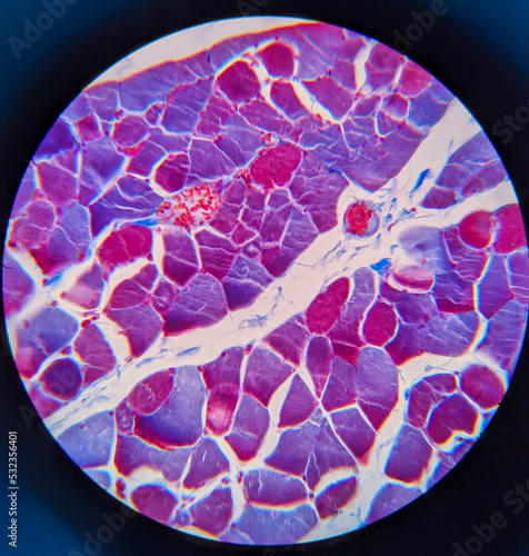 Принти на полотні photo of striated muscle tissue under the microscope
