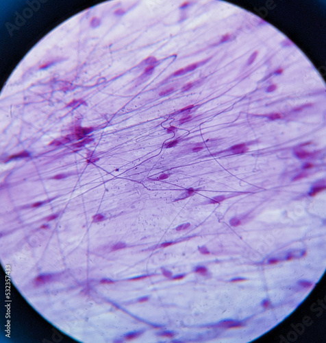 photo of loosen connective tissue underr the microscope photo