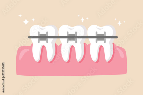 Dentist who put braces on the people gum. Dentist concept. Colored flat vector illustration.