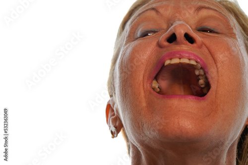 Elderly female patient opens her mouth and shows her teeth. Dental problems