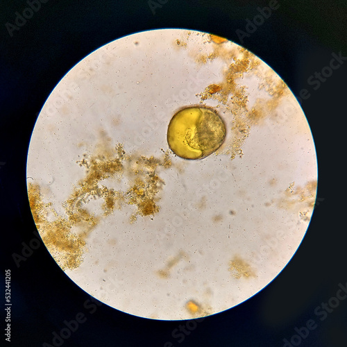 Urbanorium parasite analyzed under a microscope