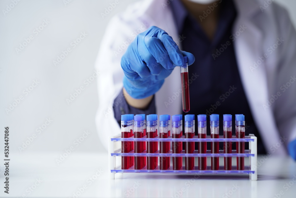 Lab worker preparing test blood for detection of antibodies and infections Corona virus.
Lab worker preparing test blood for detection of antibodies and infections Corona virus.