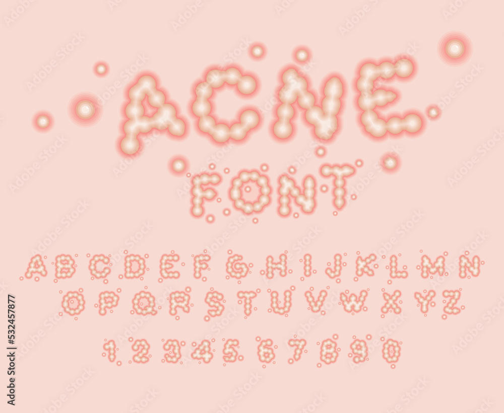 Acne font. Pimple letters. Allergy letters. ABC whelk. pustule alphabet.