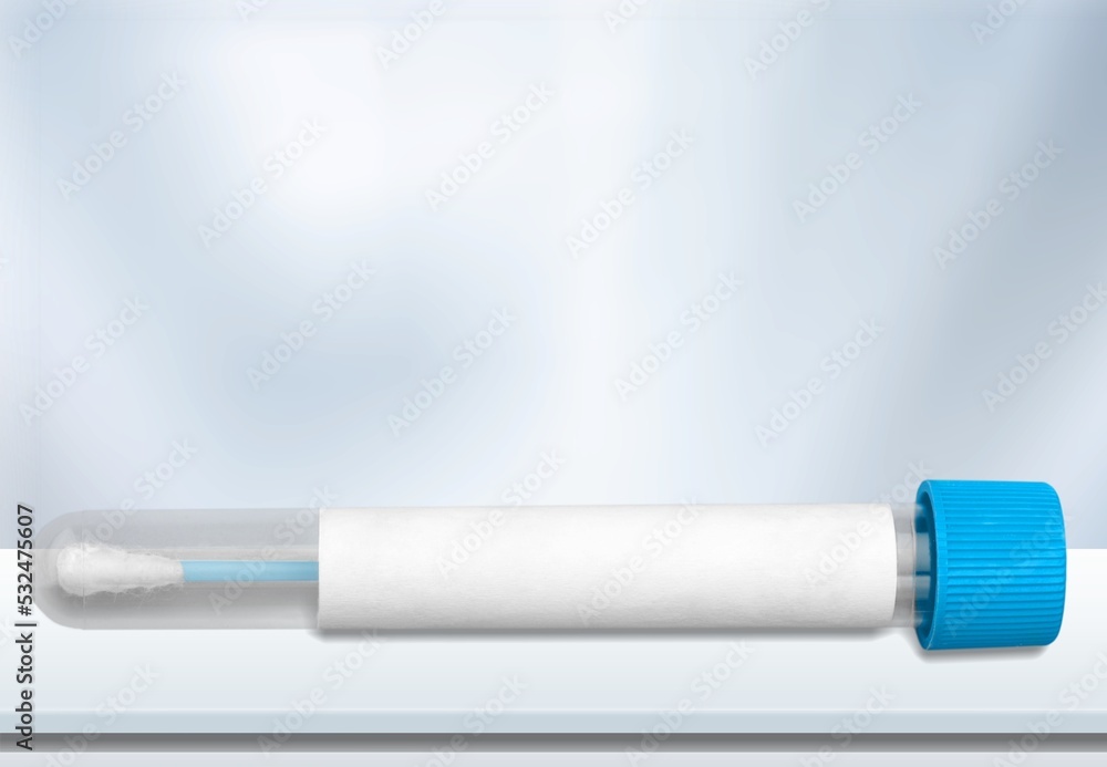Monkeypox test tube on pastel gradient background. Medical virus diagnostics. Concept of monkeypox. Monkeypox test tube on pastel gradient background. Medical virus diagnostics. Concept of monkeypox.