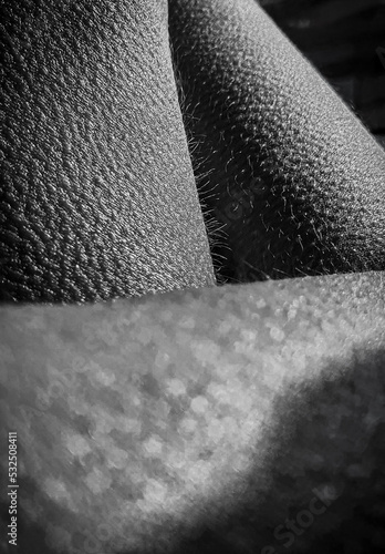 Detail of goosebumps on woman skin photo