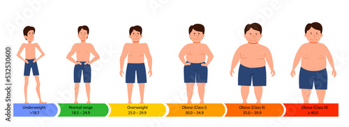 Categories with body mass index. male silhouettes with a thick, normal and slender figure. Flat vector infographics with people with different metabolism and weight. photo