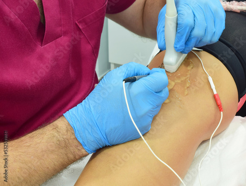 Physiotherapy  specialist doctor doing percutaneous electrolysis to the patient. Invasive technique.