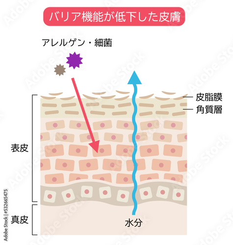 バリア機能が低い皮膚　肌細胞と断面図