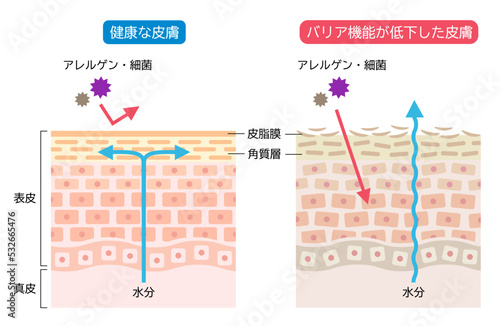 バリア機能が低下した皮膚と健康な皮膚　肌細胞と断面図