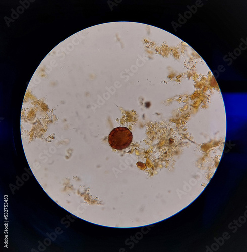 Ascaris lumbricoides egg laboratory microscope