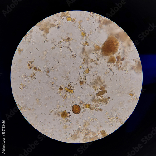Taenia sp egg microscope  parasitology laboratory