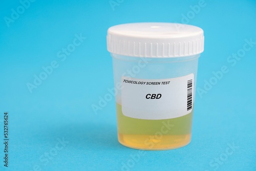 CBD. CBD toxicology screen urine tests for doping and drugs