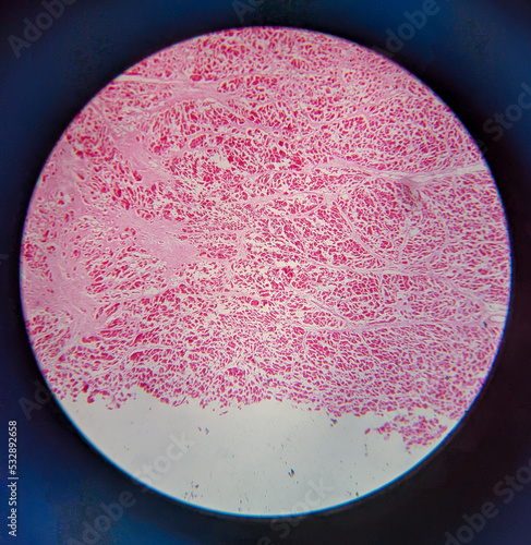 Fotografi photo of tissue under the microscope