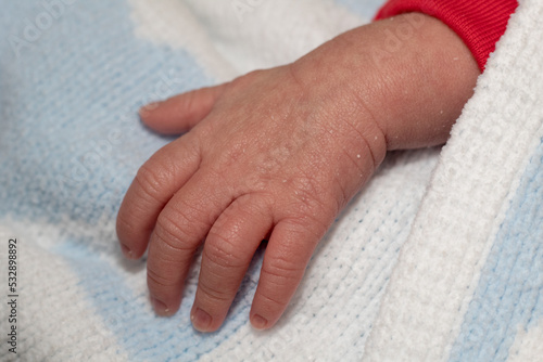 Close up of newborn's hand with skin peeling as natural process.
