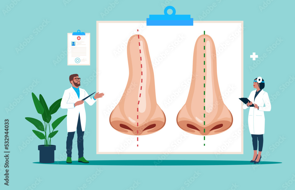 Curve and nose, surgery rhinoplasty, correction nasal curvature. Nose