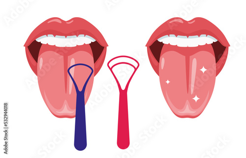 Halitosis prevention. Before and after tongue cleaning. Clean tongue throat cleaner scraper in mouth. Flat vector illustration.