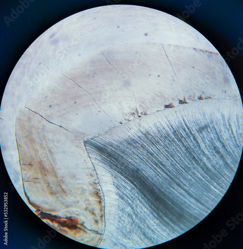 photo of tissue under the microscope photo