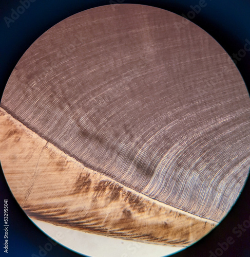 photo of tissue under the microscope photo