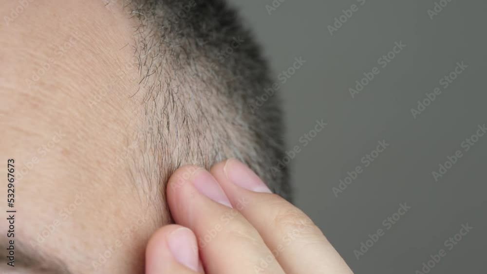 Part of a man head. The man touches his hair with his hand. The concept of hair health, the beauty of men. Seborrheic dermatitis. Part of a man head. The man touches his hair with his hand. The concept of hair health, the beauty of men. Seborrheic dermatitis.