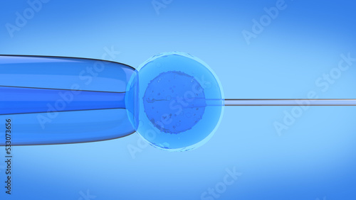 Vászonkép In vitro fertilization (IVF) is a process of fertilization where an egg is combined with sperm in vitro
